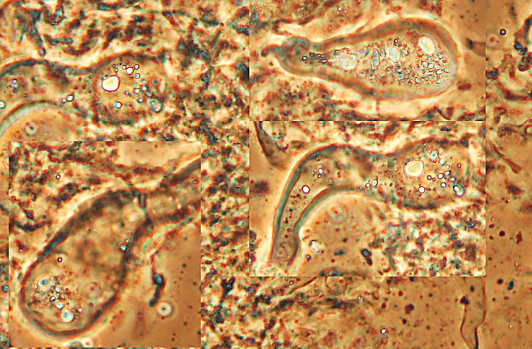 Vuilleminia sp. con cistidi giganti (Vuilleminia comedens)